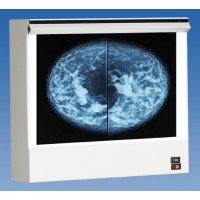 wolf_x-ray_vu_plus_mammography_illuminator_view_box