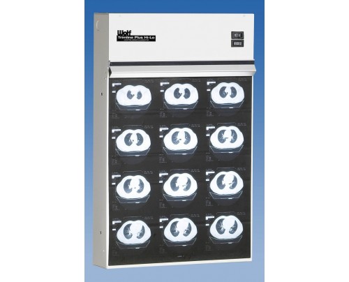 wolf_x-ray_trimline_plus_hi-lo_series_illuminator_view_boxes