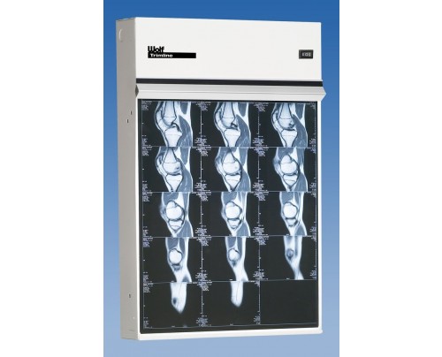 wolf_trimline_series_x-ray_illuminators_view_boxes