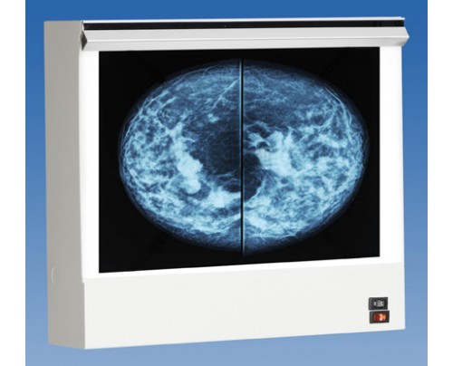 wolf_x-ray_vu_plus_mammography_illuminator_view_box